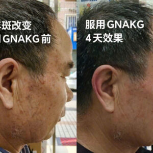 chống lão hóa GnAKG -HIGO - NAM