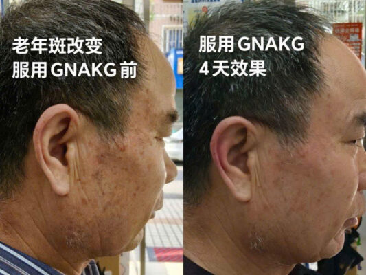 chống lão hóa GnAKG -HIGO - NAM