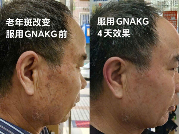 chống lão hóa GnAKG -HIGO - NAM